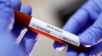 Mais um bancário morre em consequência do Coronavirus; são cinco mortes na categoria