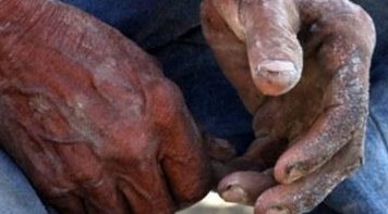 DIREITOS HUMANOS:  Governo recua e reedita portaria sobre trabalho escravo