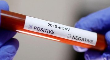 Teto dos Gastos tem de cair para salvar economia da crise provocada pelo coronavírus 