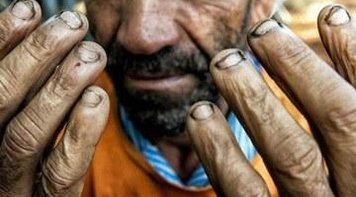 DANO MORAL:  TST condena fazendeiros no Pará por trabalho escravo