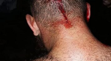 Estudante da UFPR com boné do MST é espancado aos gritos de “Aqui é Bolsonaro”